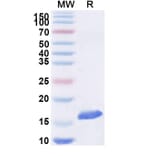 SDS-PAGE - Anti-SARS-CoV-2 Spike Protein Nanobody [SAA1074] (A338070) - Antibodies.com