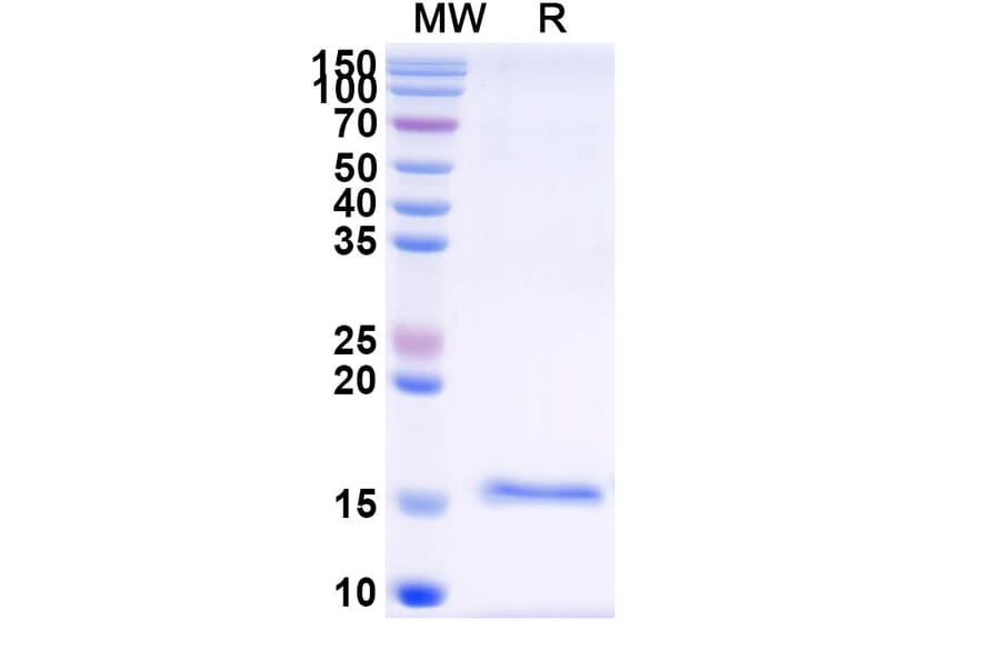 SDS-PAGE - Anti-SARS-CoV-2 Spike Protein Nanobody [SAA1075] (A338071) - Antibodies.com