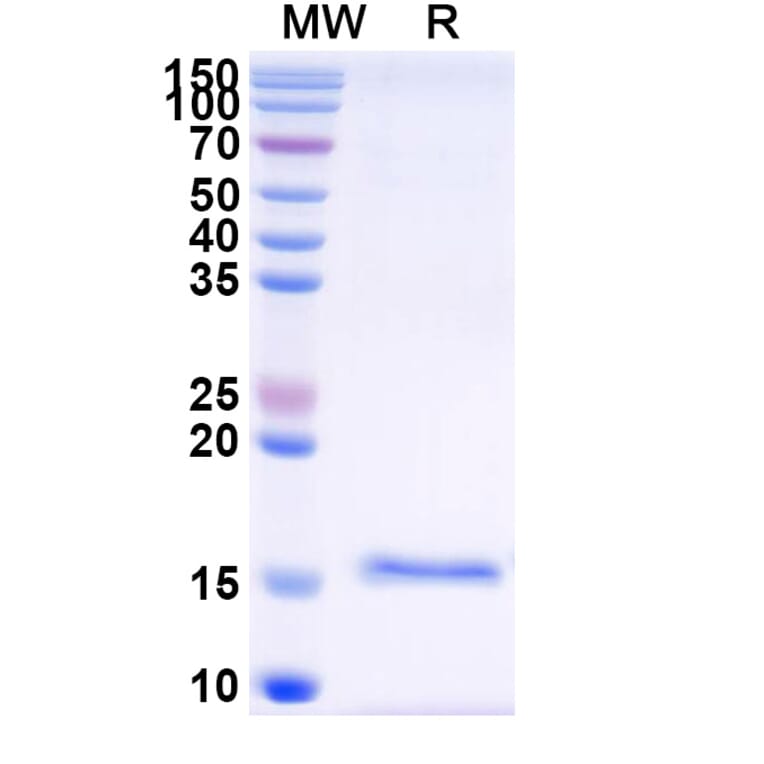 SDS-PAGE - Anti-SARS-CoV-2 Spike Protein Nanobody [SAA1075] (A338071) - Antibodies.com