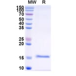 SDS-PAGE - Anti-SARS-CoV-2 Spike Protein Nanobody [SAA1075] (A338071) - Antibodies.com