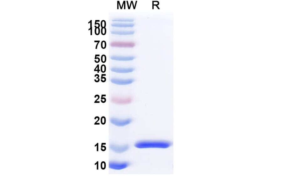 SDS-PAGE - Anti-SARS-CoV-2 Spike Protein Nanobody [SAA1076] (A338072) - Antibodies.com