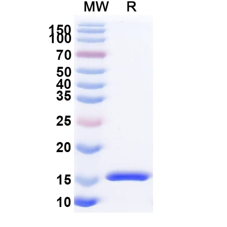 SDS-PAGE - Anti-SARS-CoV-2 Spike Protein Nanobody [SAA1076] (A338072) - Antibodies.com