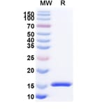 SDS-PAGE - Anti-SARS-CoV-2 Spike Protein Nanobody [SAA1076] (A338072) - Antibodies.com