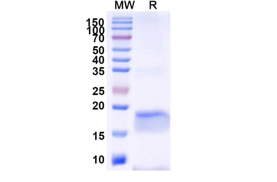 SDS-PAGE - Anti-SARS-CoV-2 Spike Protein Nanobody [SAA1077] (A338073) - Antibodies.com