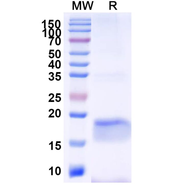SDS-PAGE - Anti-SARS-CoV-2 Spike Protein Nanobody [SAA1077] (A338073) - Antibodies.com