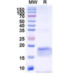 SDS-PAGE - Anti-SARS-CoV-2 Spike Protein Nanobody [SAA1077] (A338073) - Antibodies.com
