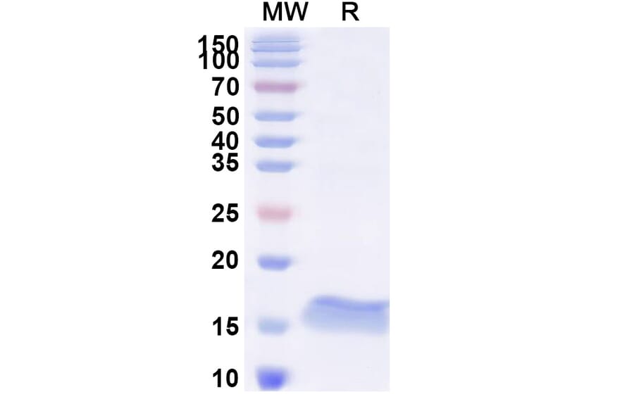 SDS-PAGE - Anti-SARS-CoV-2 Spike Protein Nanobody [SAA1081] (A338074) - Antibodies.com