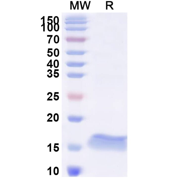 SDS-PAGE - Anti-SARS-CoV-2 Spike Protein Nanobody [SAA1081] (A338074) - Antibodies.com