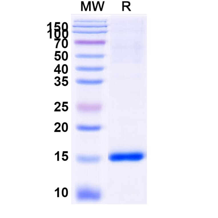 SDS-PAGE - Anti-SARS-CoV-2 Spike Protein Nanobody [SAA1082] (A338075) - Antibodies.com