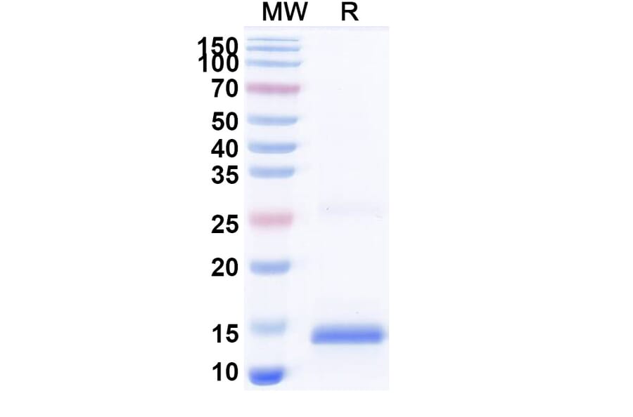 SDS-PAGE - Anti-SARS-CoV-2 Spike Protein Nanobody [SAA1084] (A338076) - Antibodies.com
