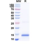 SDS-PAGE - Anti-SARS-CoV-2 Spike Protein Nanobody [SAA1084] (A338076) - Antibodies.com