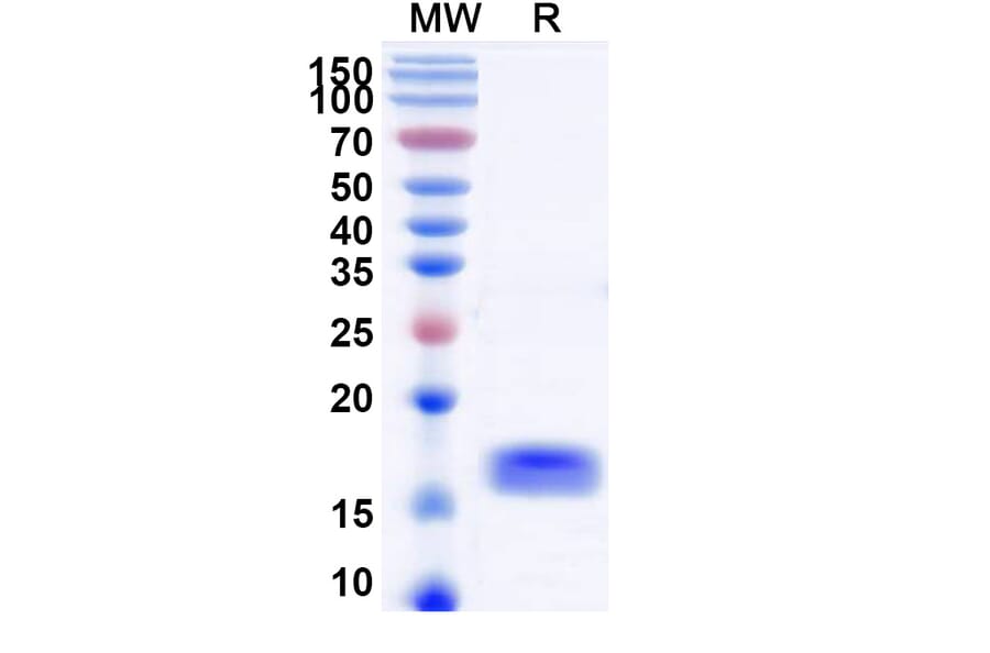 SDS-PAGE - Anti-SARS-CoV-2 Spike Protein Nanobody [SAA1087] (A338077) - Antibodies.com