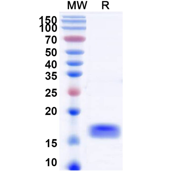 SDS-PAGE - Anti-SARS-CoV-2 Spike Protein Nanobody [SAA1087] (A338077) - Antibodies.com