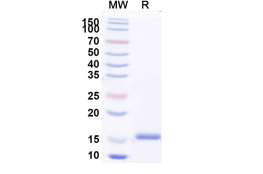SDS-PAGE - Anti-SARS-CoV-2 Spike Protein Nanobody [SAA1089] (A338078) - Antibodies.com