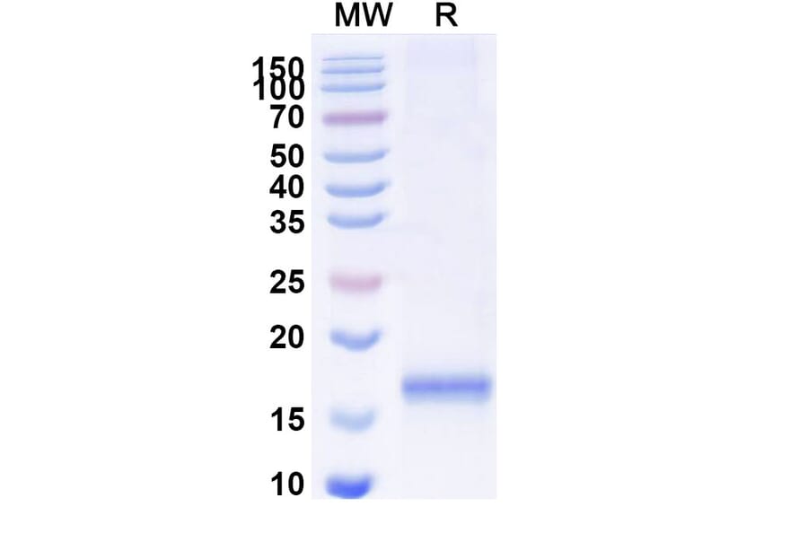 SDS-PAGE - Anti-SARS-CoV-2 Spike Protein Nanobody [SAA1091] (A338079) - Antibodies.com