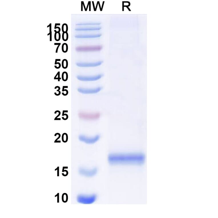 SDS-PAGE - Anti-SARS-CoV-2 Spike Protein Nanobody [SAA1091] (A338079) - Antibodies.com