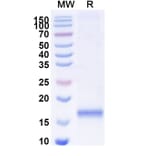 SDS-PAGE - Anti-SARS-CoV-2 Spike Protein Nanobody [SAA1091] (A338079) - Antibodies.com