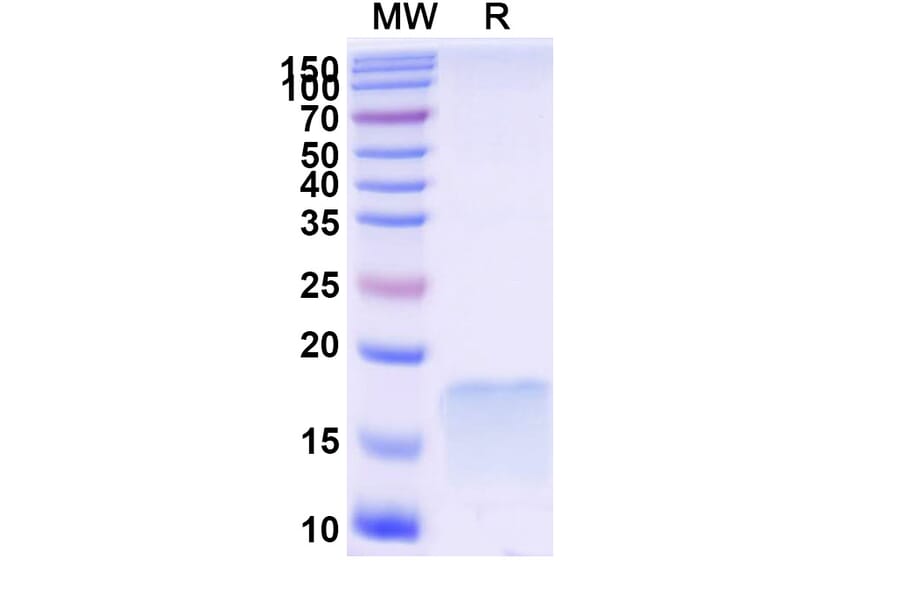 SDS-PAGE - Anti-SARS-CoV-2 Spike Protein Nanobody [SAA1092] (A338080) - Antibodies.com