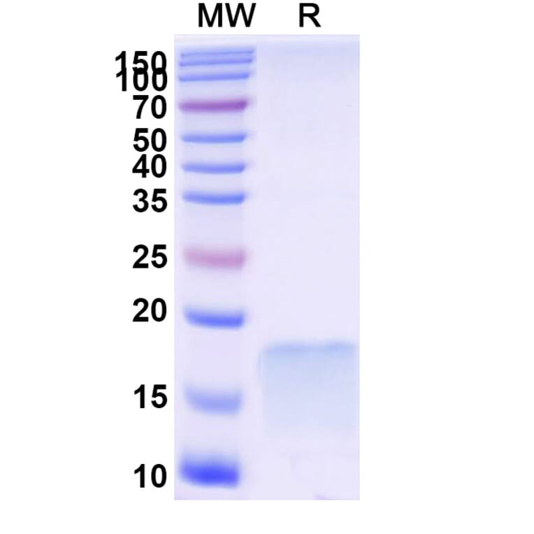 SDS-PAGE - Anti-SARS-CoV-2 Spike Protein Nanobody [SAA1092] (A338080) - Antibodies.com