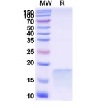SDS-PAGE - Anti-SARS-CoV-2 Spike Protein Nanobody [SAA1092] (A338080) - Antibodies.com