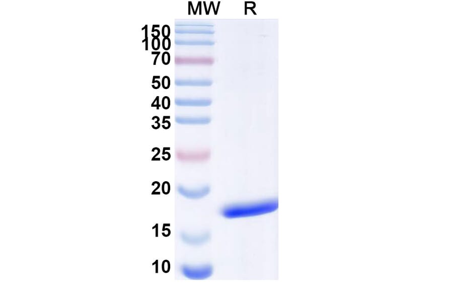 SDS-PAGE - Anti-SARS-CoV-2 Spike Protein Nanobody [SAA1093] (A338081) - Antibodies.com