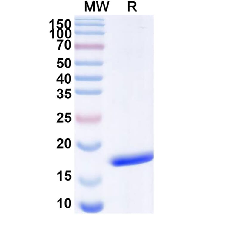 SDS-PAGE - Anti-SARS-CoV-2 Spike Protein Nanobody [SAA1093] (A338081) - Antibodies.com