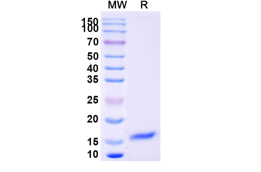 SDS-PAGE - Anti-SARS-CoV-2 Spike Protein Nanobody [SAA1094] (A338082) - Antibodies.com