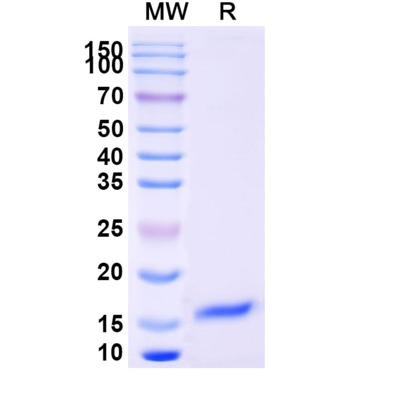 SDS-PAGE - Anti-SARS-CoV-2 Spike Protein Nanobody [SAA1094] (A338082) - Antibodies.com