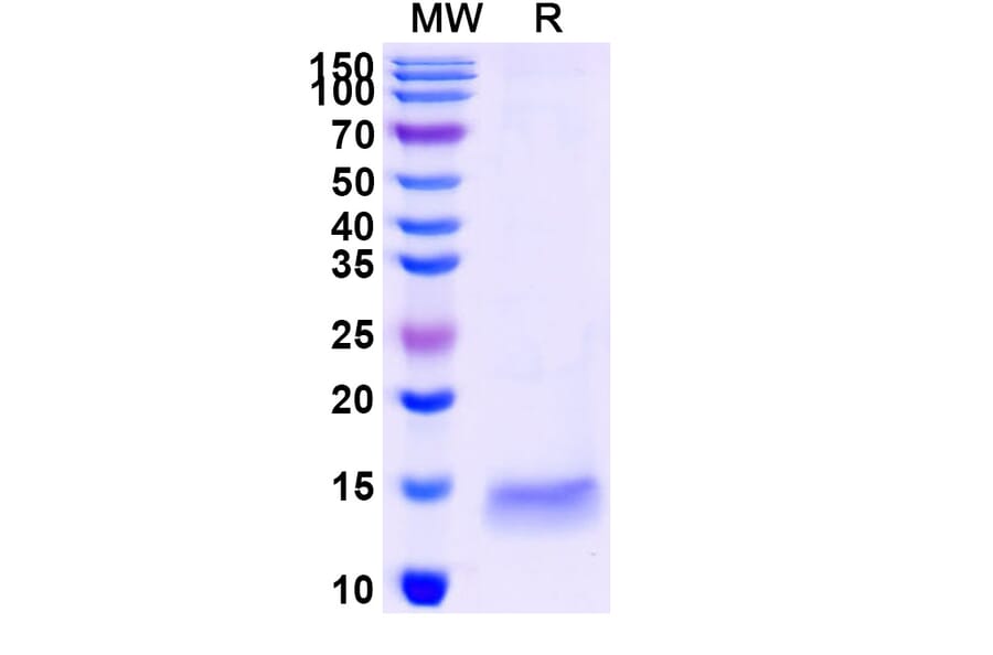 SDS-PAGE - Anti-SARS-CoV-2 Spike Protein Nanobody [SAA1096] (A338083) - Antibodies.com
