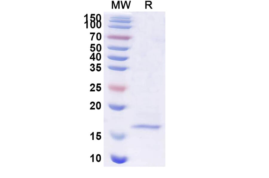 SDS-PAGE - Anti-SARS-CoV-2 Spike Protein Nanobody [SAA1099] (A338084) - Antibodies.com