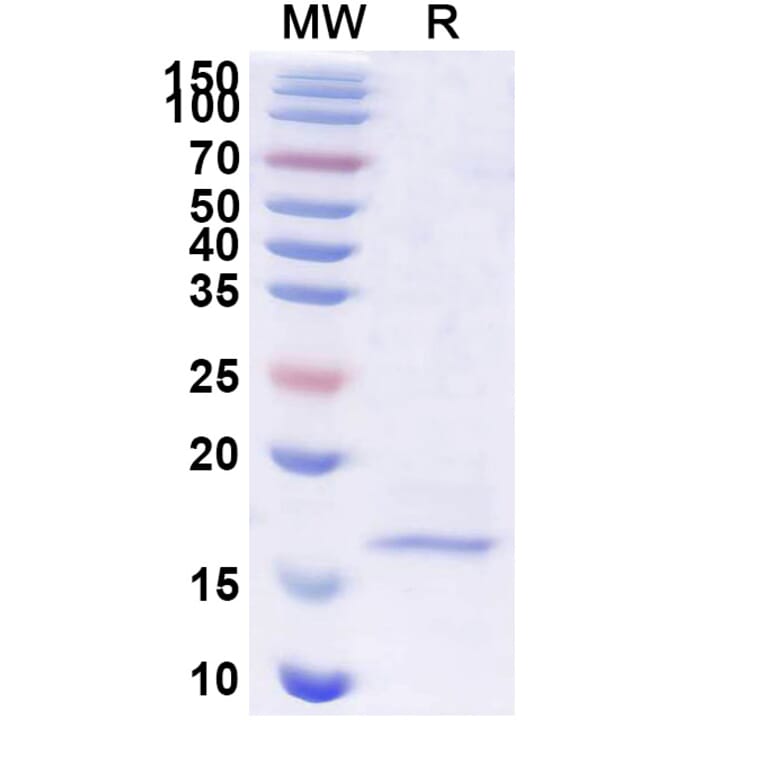 SDS-PAGE - Anti-SARS-CoV-2 Spike Protein Nanobody [SAA1099] (A338084) - Antibodies.com