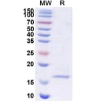 SDS-PAGE - Anti-SARS-CoV-2 Spike Protein Nanobody [SAA1099] (A338084) - Antibodies.com