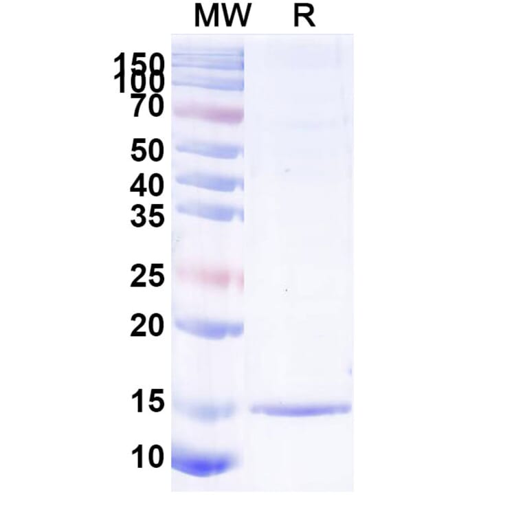 SDS-PAGE - Anti-SARS-CoV-2 Spike Protein Nanobody [SAA1100] (A338085) - Antibodies.com