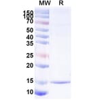 SDS-PAGE - Anti-SARS-CoV-2 Spike Protein Nanobody [SAA1100] (A338085) - Antibodies.com