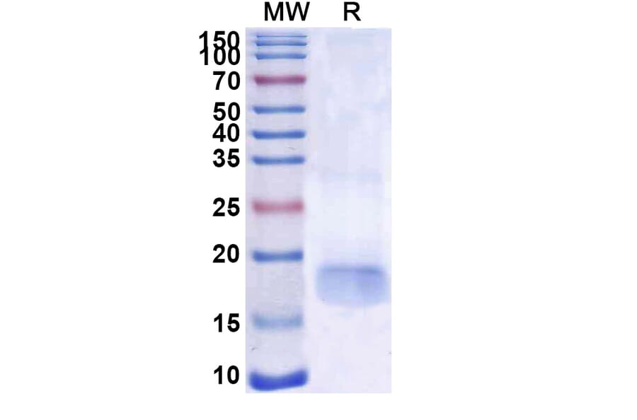 SDS-PAGE - Anti-SARS-CoV-2 Spike Protein Nanobody [SAA1101] (A338086) - Antibodies.com