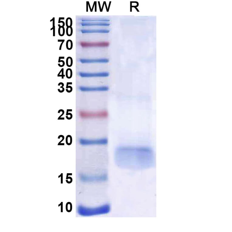SDS-PAGE - Anti-SARS-CoV-2 Spike Protein Nanobody [SAA1101] (A338086) - Antibodies.com
