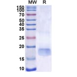 SDS-PAGE - Anti-SARS-CoV-2 Spike Protein Nanobody [SAA1101] (A338086) - Antibodies.com