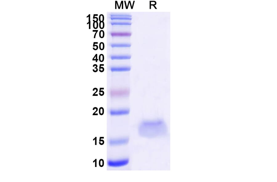 SDS-PAGE - Anti-SARS-CoV-2 Spike Protein Nanobody [SAA1102] (A338087) - Antibodies.com