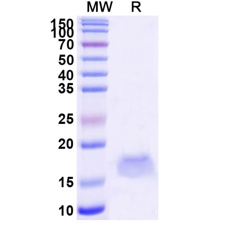 SDS-PAGE - Anti-SARS-CoV-2 Spike Protein Nanobody [SAA1102] (A338087) - Antibodies.com