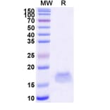 SDS-PAGE - Anti-SARS-CoV-2 Spike Protein Nanobody [SAA1102] (A338087) - Antibodies.com