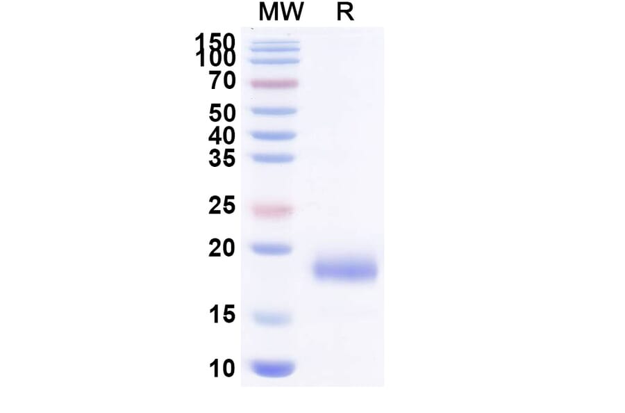 SDS-PAGE - Anti-SARS-CoV-2 Spike Protein Nanobody [SAA1103] (A338088) - Antibodies.com