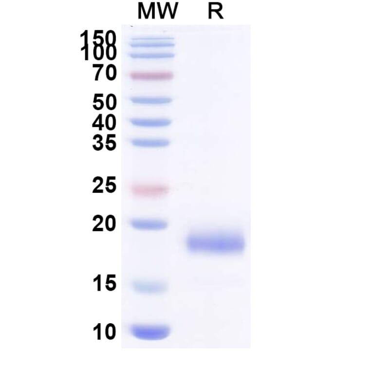 SDS-PAGE - Anti-SARS-CoV-2 Spike Protein Nanobody [SAA1103] (A338088) - Antibodies.com