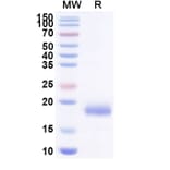 SDS-PAGE - Anti-SARS-CoV-2 Spike Protein Nanobody [SAA1103] (A338088) - Antibodies.com