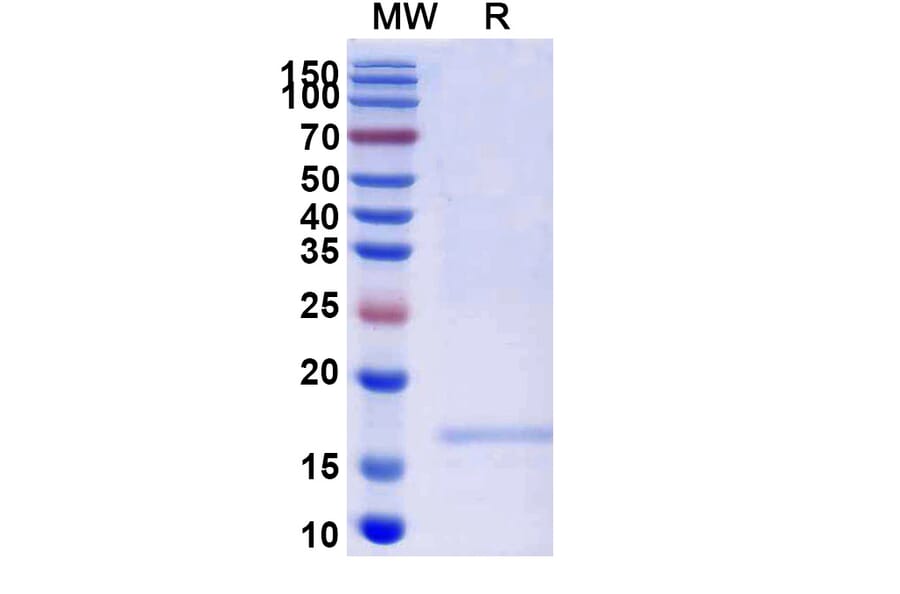 SDS-PAGE - Anti-SARS-CoV-2 Spike Protein Nanobody [SAA1105] (A338089) - Antibodies.com