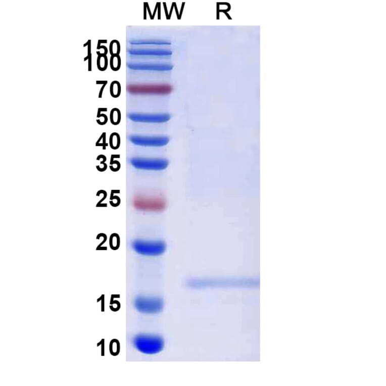 SDS-PAGE - Anti-SARS-CoV-2 Spike Protein Nanobody [SAA1105] (A338089) - Antibodies.com