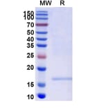 SDS-PAGE - Anti-SARS-CoV-2 Spike Protein Nanobody [SAA1105] (A338089) - Antibodies.com