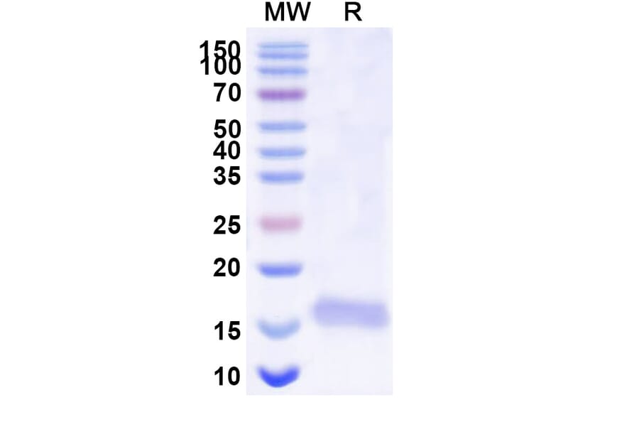 SDS-PAGE - Anti-SARS-CoV-2 Spike Protein Nanobody [SAA1108] (A338090) - Antibodies.com