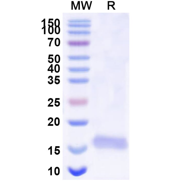 SDS-PAGE - Anti-SARS-CoV-2 Spike Protein Nanobody [SAA1108] (A338090) - Antibodies.com
