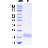 SDS-PAGE - Anti-SARS-CoV-2 Spike Protein Nanobody [SAA1108] (A338090) - Antibodies.com