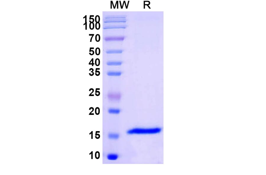 SDS-PAGE - Anti-SARS-CoV-2 Spike Protein Nanobody [SAA1109] (A338091) - Antibodies.com